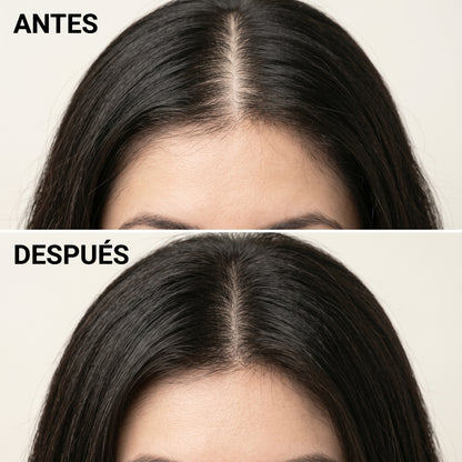 Korean Scalp Bar — Fórmula Postparto