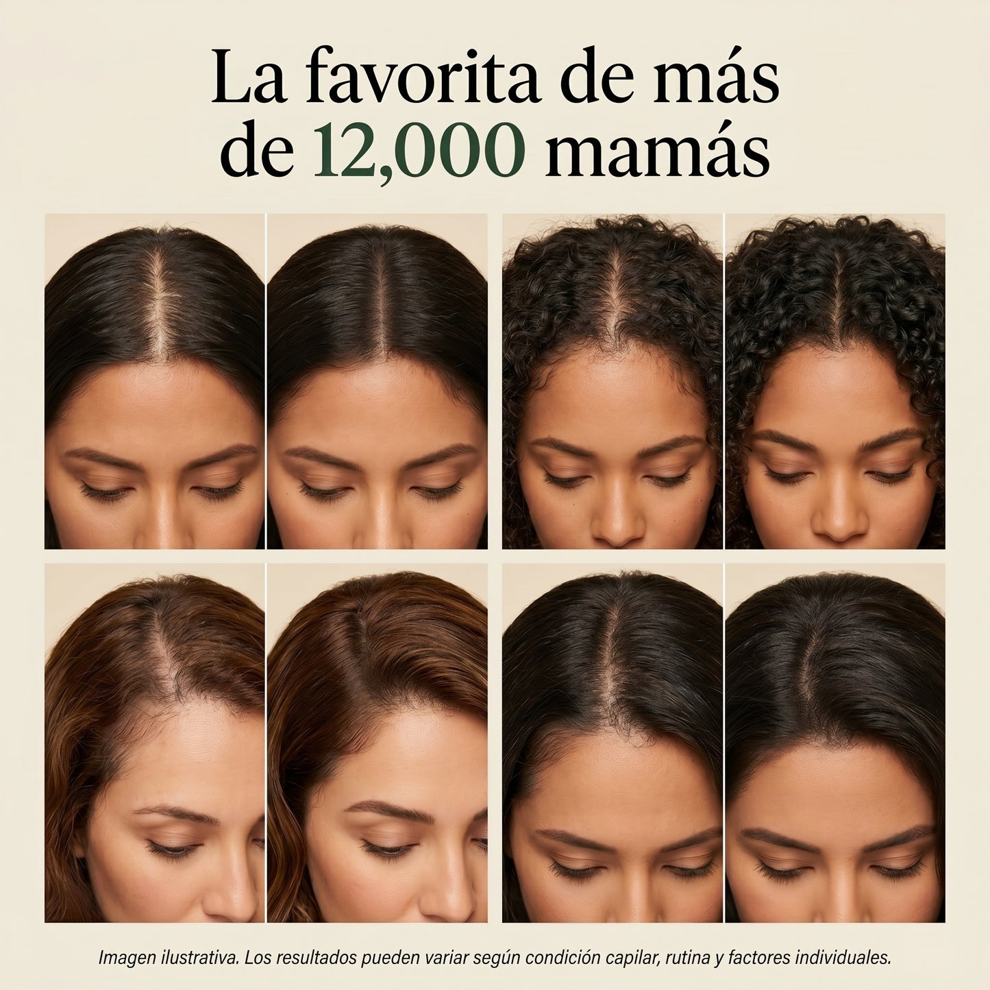 Korean Scalp Bar — Fórmula Postparto